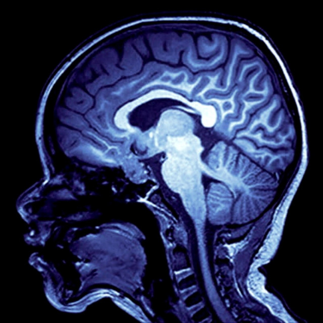 Minds Taken